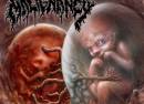 Malignancy