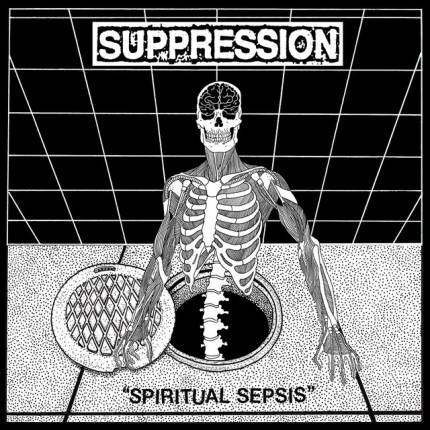Suppression