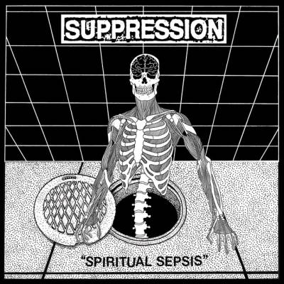 Suppression