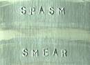 Spasm