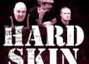 Hard Skin